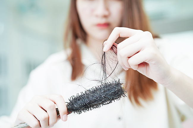Not just men, even women suffer from receding hairline | Borneo Bulletin  Online